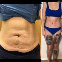 Slider image (1) KCM Clinic